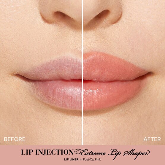 Lip Injection L�pis de Boca Post Op Pink
